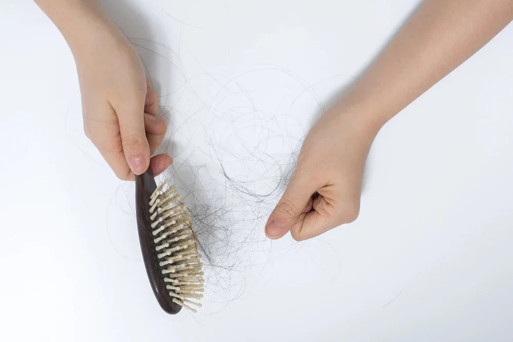 Postpartum Hair Loss